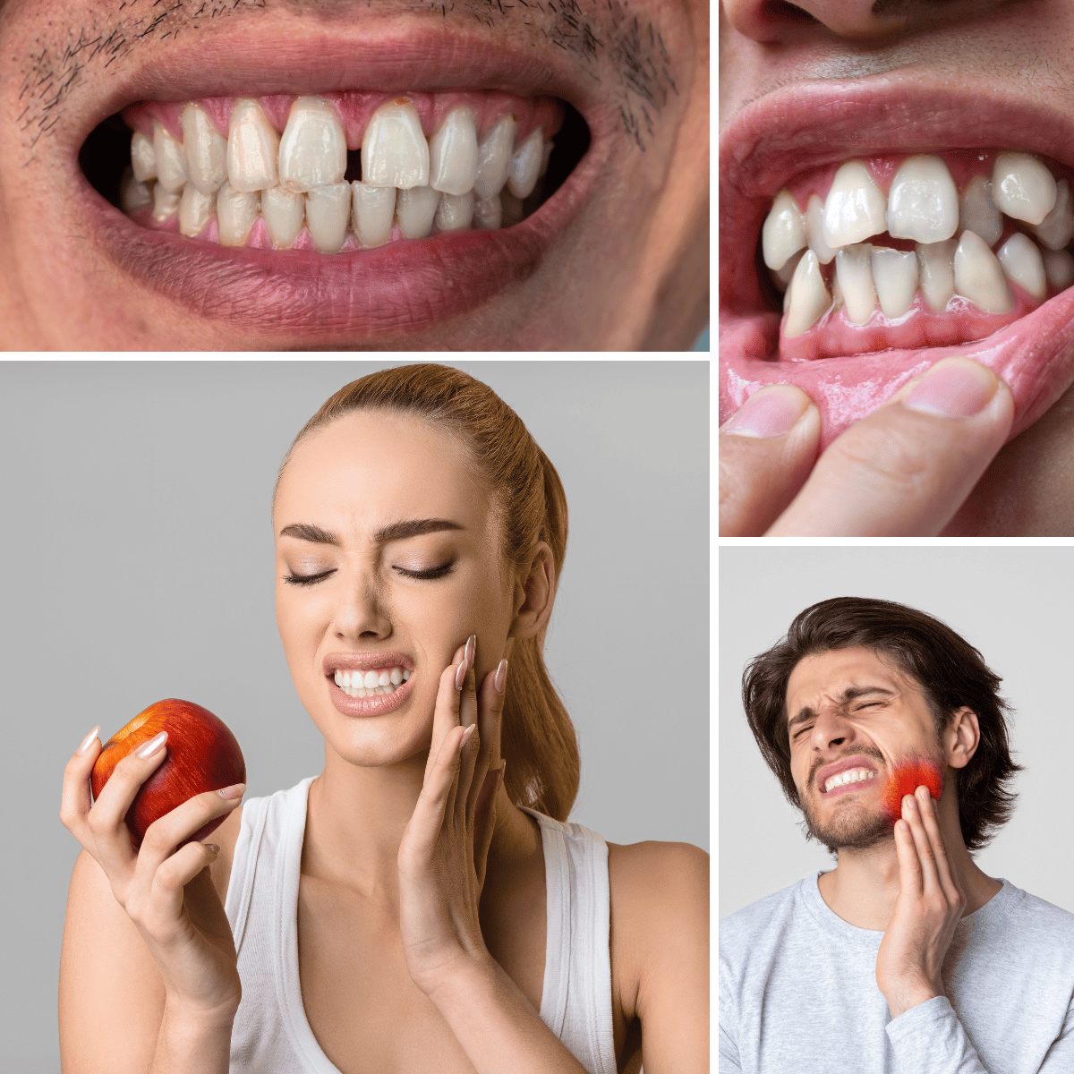 Invisalign in El Monte, CA - Angel Dental Care (10) Invisalign in El Monte, CA - Angel Dental Care